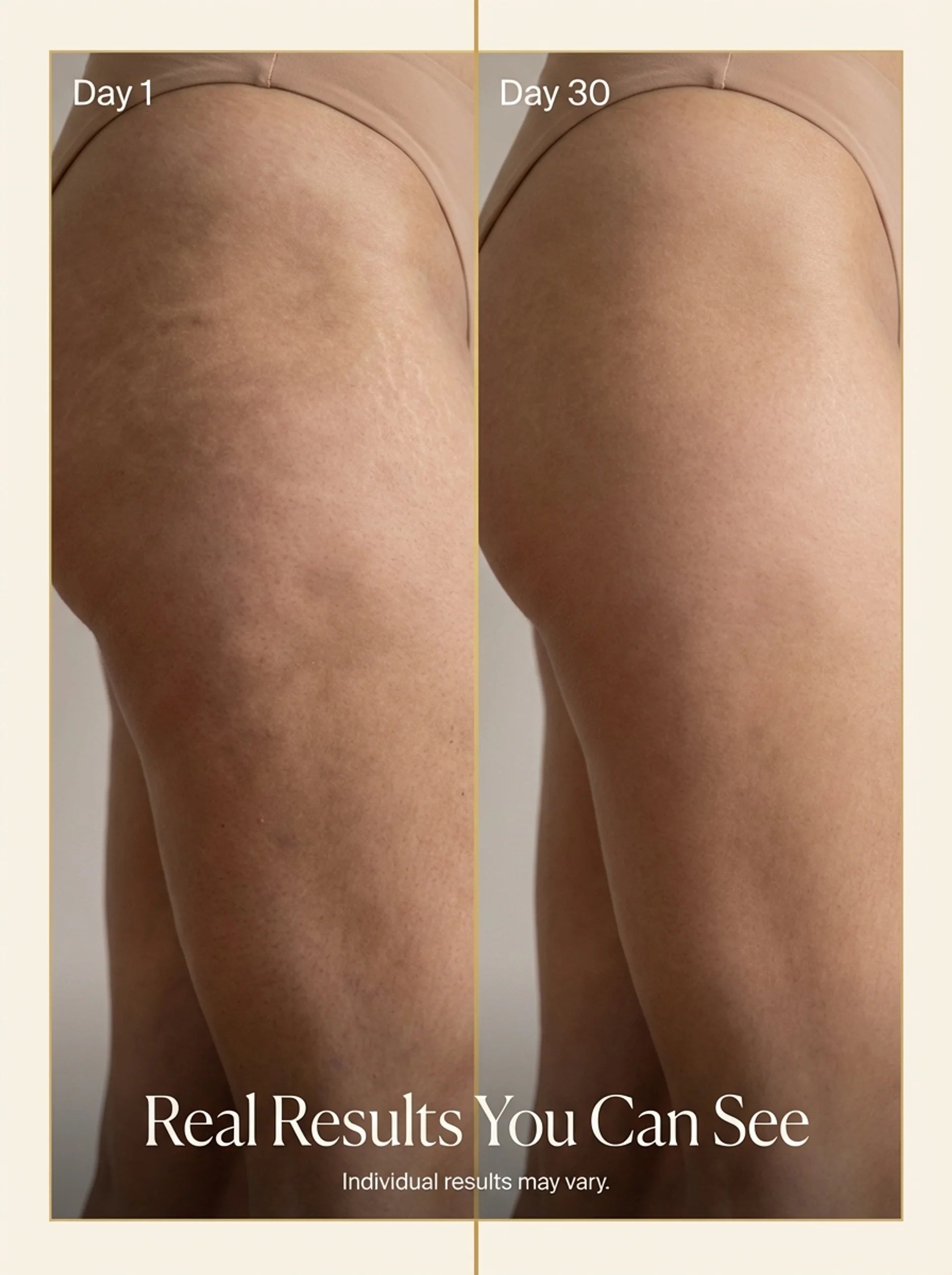 MIRELLA MAISON | FIRMING & ANTI-CELLULITE BODY OIL